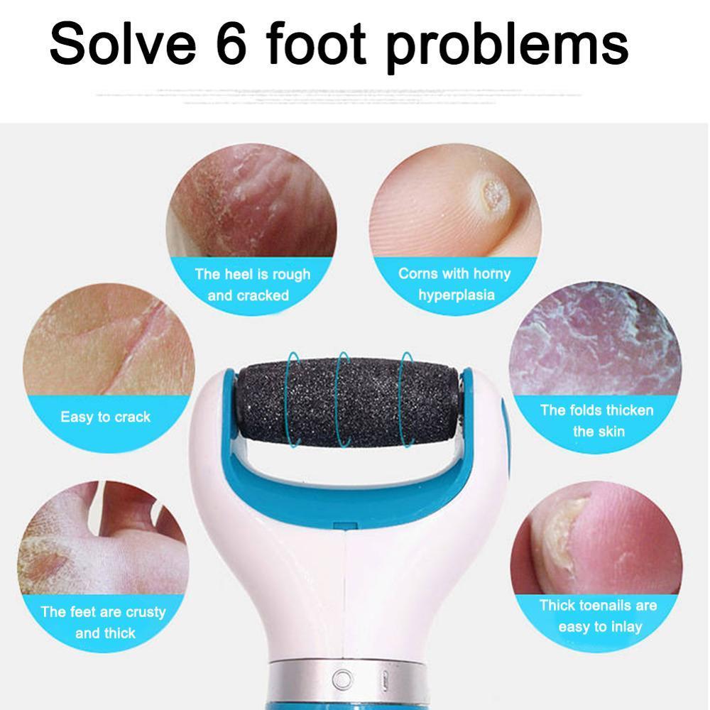 Callus Remover Foot Grinder Pedicure