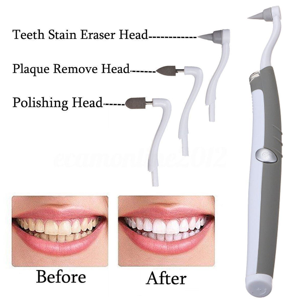 Sonic Tooth Stain Eraser With Plaque Remover - Balma Home