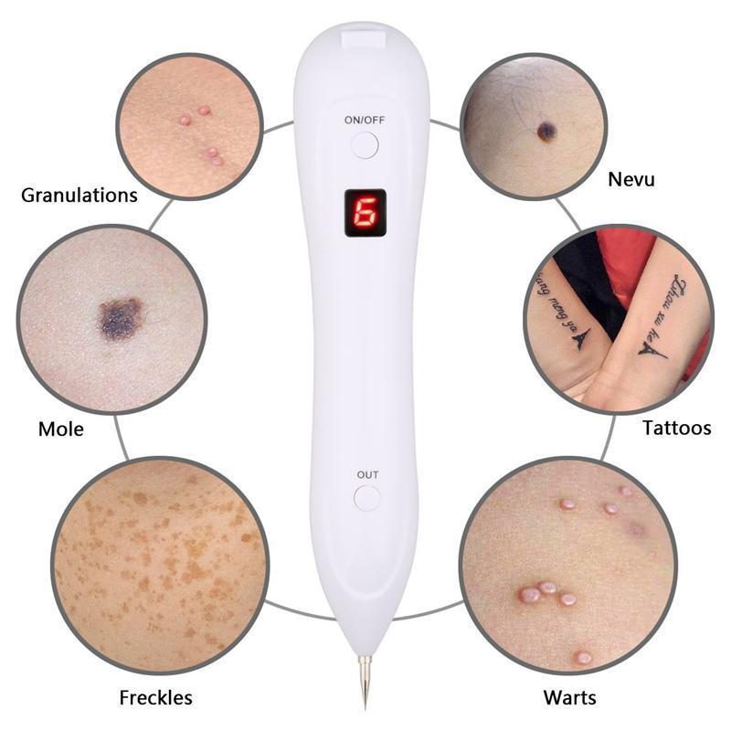 Laser Skin Tags Removal Pen With LCD Display